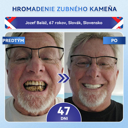 Guxar® Tideglusib ústne prúžky ✨ – aktivácia kmeňových buniek 🧬, regenerácia dentínu 💎, posilnenie skloviny ⚡, bielenie zubov ✨, zníženie citlivosti 💧, mikronáplasťové sérum na zuby a ďasná 💖, jemné každodenné používanie 🦷
