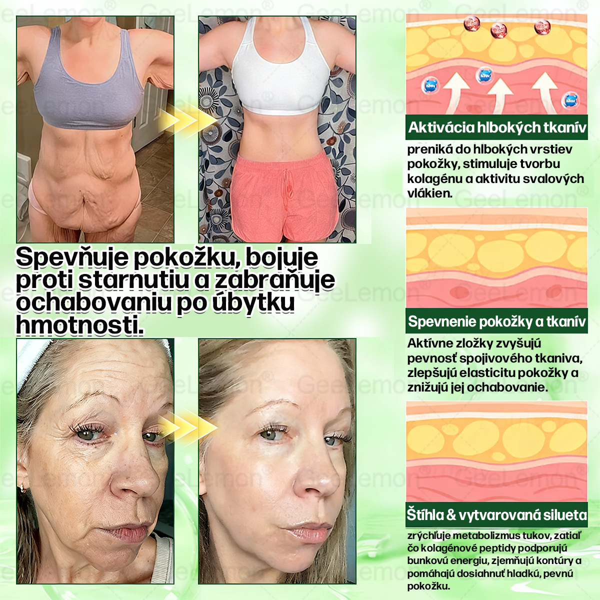 𝐆𝐞𝐞𝐋𝐞𝐦𝐨𝐧® 📌𝐆𝐥𝐮𝐦𝐚𝐬𝐞𝐭𝐢𝐝𝐚 8 v 1 Náplast s Nano Mikroihličkami na Chudnutie a Zdravie ✅ (Iba raz denne, viditeľné zmeny za 7 dní) Pre obezitu, kardiovaskulárne zdravie, cukrovku, spánkovú apneu, štítnu žľazu, črevné zdravie, kĺbové problémy a ďalšie 💪