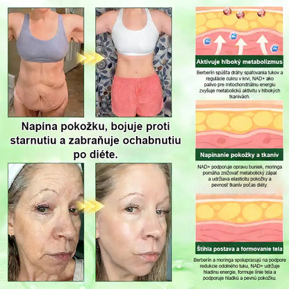 Auravie® Moringa 10-v-1 Metabolický tvarujúci krém 🌸 | Transdermálna náplasť na podporu regulácie telesnej hmotnosti | Kontrola apetítu 🍽️ | Podpora spaľovania tukov 🔥 | Formovanie a spevnenie tela ✨