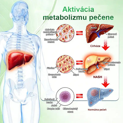 Auravie® Moringa 10-v-1 Metabolický tvarujúci krém 🌸 | Transdermálna náplasť na podporu regulácie telesnej hmotnosti | Kontrola apetítu 🍽️ | Podpora spaľovania tukov 🔥 | Formovanie a spevnenie tela ✨