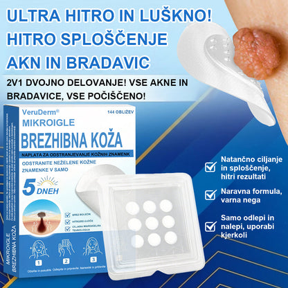 VeruDerm® 2 az 1-ben mikrotűs és hidrokolloid tapasz 🔥 | Kiemelkedő anyajegyek, pattanások, lapos szemölcsök és bőrkinövések ápolására ✅ | Segít javítani a ráncok, hegek és bőrhibák megjelenését ✨ | Láthatatlan pattanástapasz arcra és testre | 144 db 🌸🍇