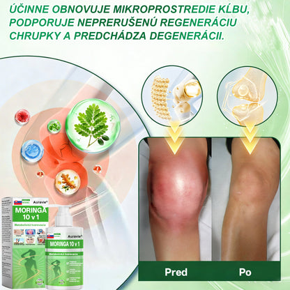 Auravie® Moringa 10-v-1 Metabolický tvarujúci krém 🌸 | Transdermálna náplasť na podporu regulácie telesnej hmotnosti | Kontrola apetítu 🍽️ | Podpora spaľovania tukov 🔥 | Formovanie a spevnenie tela ✨