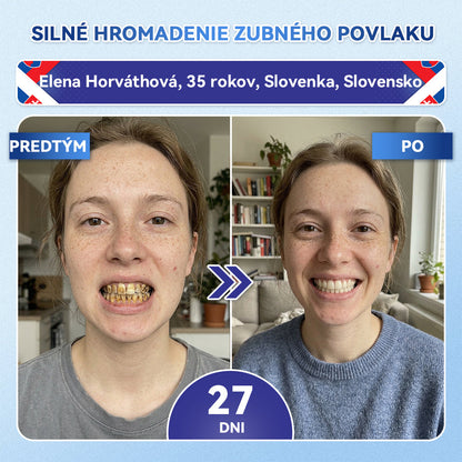 Guxar® Tideglusib ústne prúžky ✨ – aktivácia kmeňových buniek 🧬, regenerácia dentínu 💎, posilnenie skloviny ⚡, bielenie zubov ✨, zníženie citlivosti 💧, mikronáplasťové sérum na zuby a ďasná 💖, jemné každodenné používanie 🦷