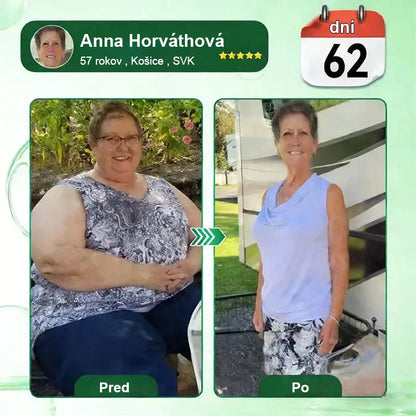 Auravie® Moringa 10-v-1 Metabolický tvarujúci krém 🌸 | Transdermálna náplasť na podporu regulácie telesnej hmotnosti | Kontrola apetítu 🍽️ | Podpora spaľovania tukov 🔥 | Formovanie a spevnenie tela ✨