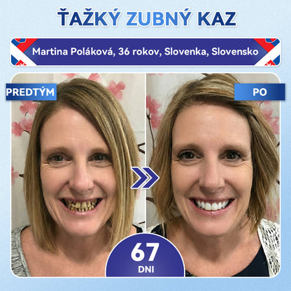 Guxar® Tideglusib ústne prúžky ✨ – aktivácia kmeňových buniek 🧬, regenerácia dentínu 💎, posilnenie skloviny ⚡, bielenie zubov ✨, zníženie citlivosti 💧, mikronáplasťové sérum na zuby a ďasná 💖, jemné každodenné používanie 🦷