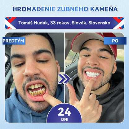 Guxar® Tideglusib ústne prúžky ✨ – aktivácia kmeňových buniek 🧬, regenerácia dentínu 💎, posilnenie skloviny ⚡, bielenie zubov ✨, zníženie citlivosti 💧, mikronáplasťové sérum na zuby a ďasná 💖, jemné každodenné používanie 🦷