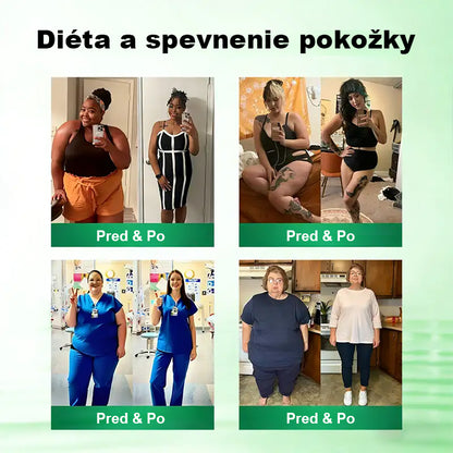 Auravie® Moringa 10-v-1 Metabolický tvarujúci krém 🌸 | Transdermálna náplasť na podporu regulácie telesnej hmotnosti | Kontrola apetítu 🍽️ | Podpora spaľovania tukov 🔥 | Formovanie a spevnenie tela ✨