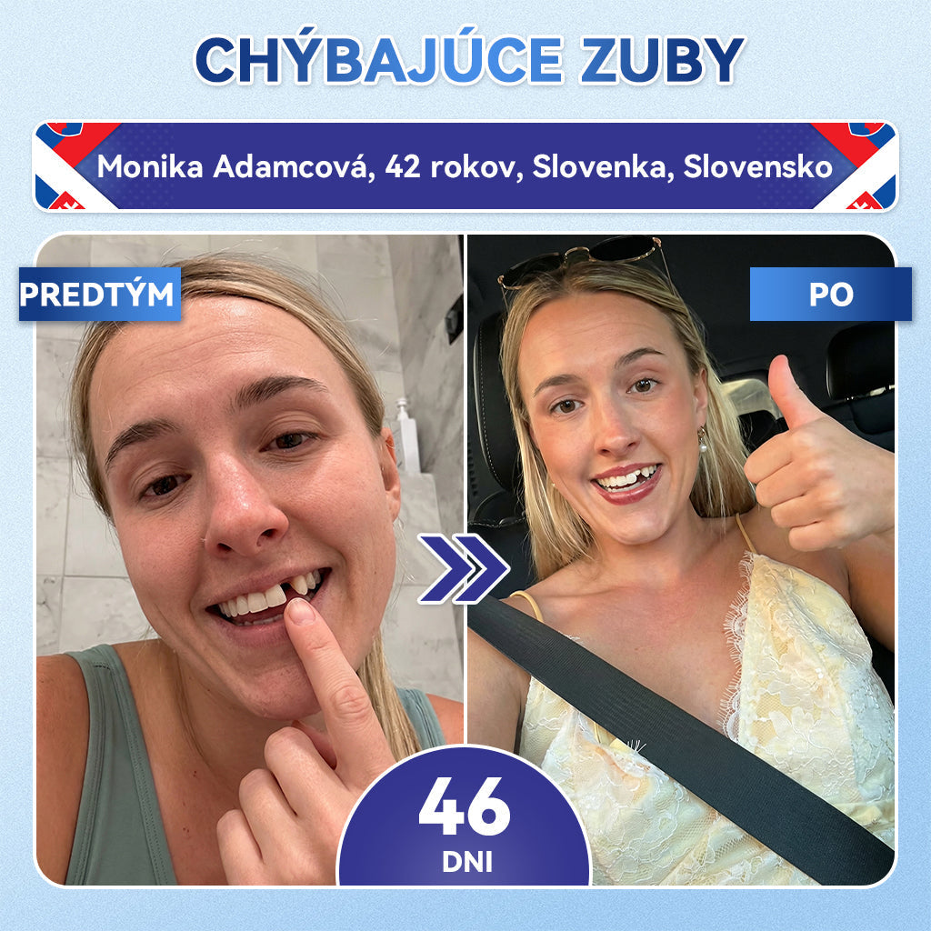 Guxar® Tideglusib ústne prúžky ✨ – aktivácia kmeňových buniek 🧬, regenerácia dentínu 💎, posilnenie skloviny ⚡, bielenie zubov ✨, zníženie citlivosti 💧, mikronáplasťové sérum na zuby a ďasná 💖, jemné každodenné používanie 🦷