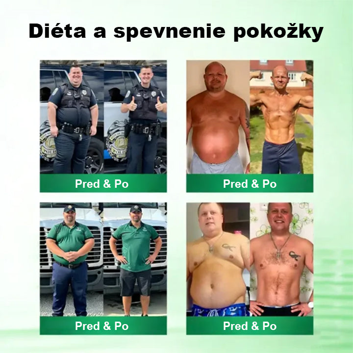 Auravie® Moringa 10-v-1 Metabolický tvarujúci krém 🌸 | Transdermálna náplasť na podporu regulácie telesnej hmotnosti | Kontrola apetítu 🍽️ | Podpora spaľovania tukov 🔥 | Formovanie a spevnenie tela ✨