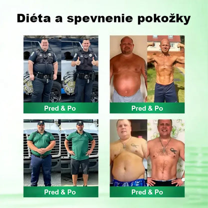 Auravie® Moringa 10-v-1 Metabolický tvarujúci krém 🌸 | Transdermálna náplasť na podporu regulácie telesnej hmotnosti | Kontrola apetítu 🍽️ | Podpora spaľovania tukov 🔥 | Formovanie a spevnenie tela ✨