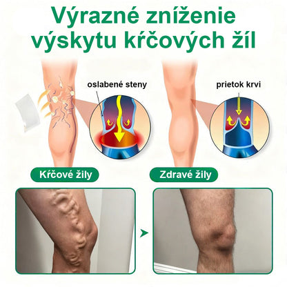Twisma® VeinTarget – pokročilá mikro náplasť na kŕčové žily🩸 🔥 96 % klinicky preukázaná účinnosť ⚡ Viditeľné výsledky už za 7–14 dní 🌿 Jemná podporná starostlivosť pre ľahšie a uvoľnenejšie nohy 🦵💪
