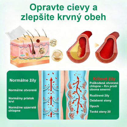Twisma® VeinTarget – pokročilá mikro náplasť na kŕčové žily🩸 🔥 96 % klinicky preukázaná účinnosť ⚡ Viditeľné výsledky už za 7–14 dní 🌿 Jemná podporná starostlivosť pre ľahšie a uvoľnenejšie nohy 🦵💪