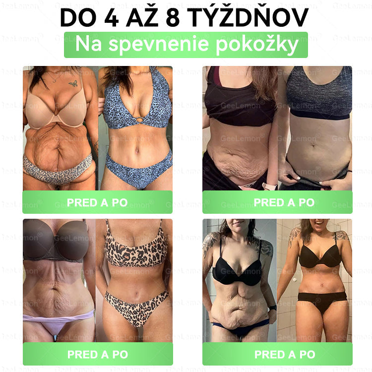 𝐆𝐞𝐞𝐋𝐞𝐦𝐨𝐧® 📌𝐆𝐥𝐮𝐦𝐚𝐬𝐞𝐭𝐢𝐝𝐚 8 v 1 Náplast s Nano Mikroihličkami na Chudnutie a Zdravie ✅ (Iba raz denne, viditeľné zmeny za 7 dní) Pre obezitu, kardiovaskulárne zdravie, cukrovku, spánkovú apneu, štítnu žľazu, črevné zdravie, kĺbové problémy a ďalšie 💪