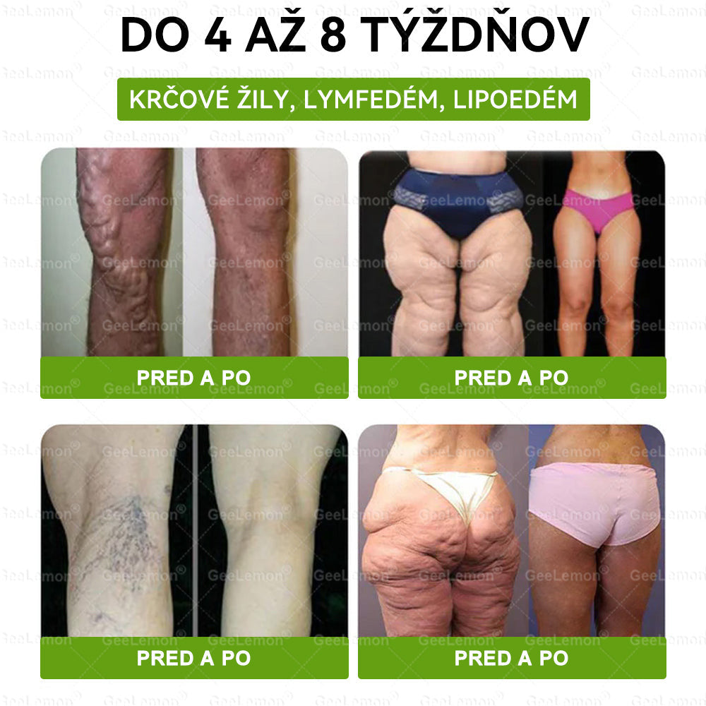 𝐆𝐞𝐞𝐋𝐞𝐦𝐨𝐧® 📌𝐆𝐥𝐮𝐦𝐚𝐬𝐞𝐭𝐢𝐝𝐚 8 v 1 Náplast s Nano Mikroihličkami na Chudnutie a Zdravie ✅ (Iba raz denne, viditeľné zmeny za 7 dní) Pre obezitu, kardiovaskulárne zdravie, cukrovku, spánkovú apneu, štítnu žľazu, črevné zdravie, kĺbové problémy a ďalšie 💪